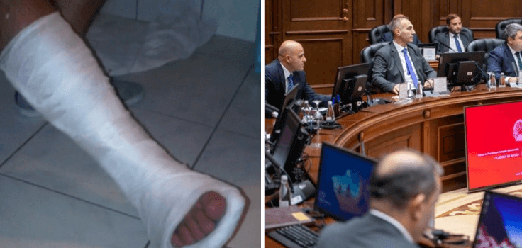 Тројца членови на владата поради брзо трчање завршија со скршени прсти на нозете